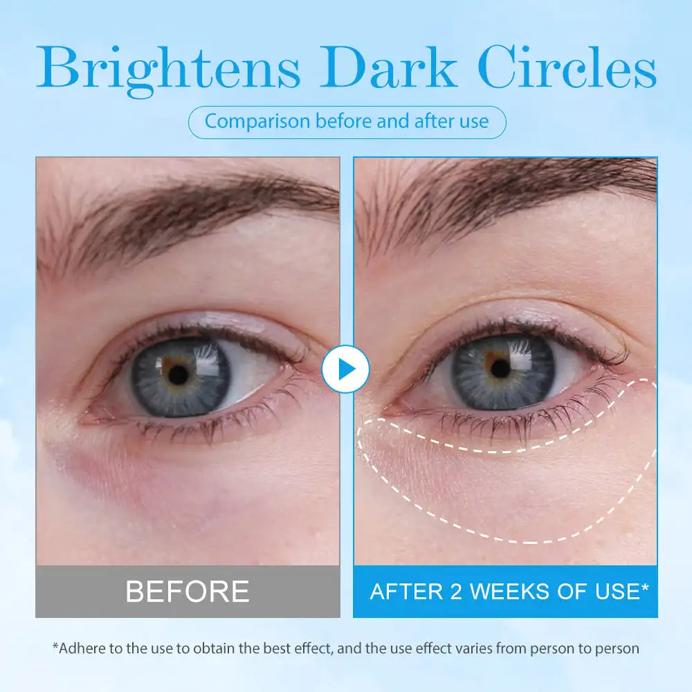 Revitalize Your Gaze, Reclaim Your Confidence!
